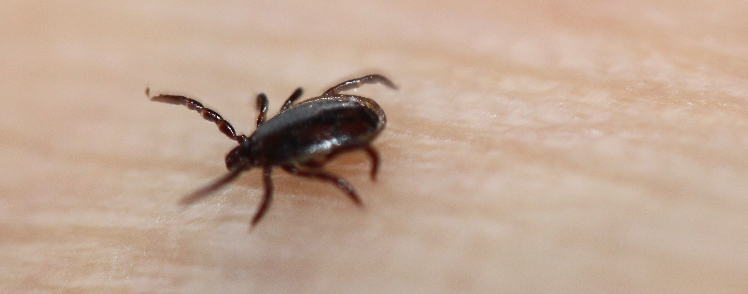 Fästing – Borrelia symptom, behandling och diagnos i Sverige